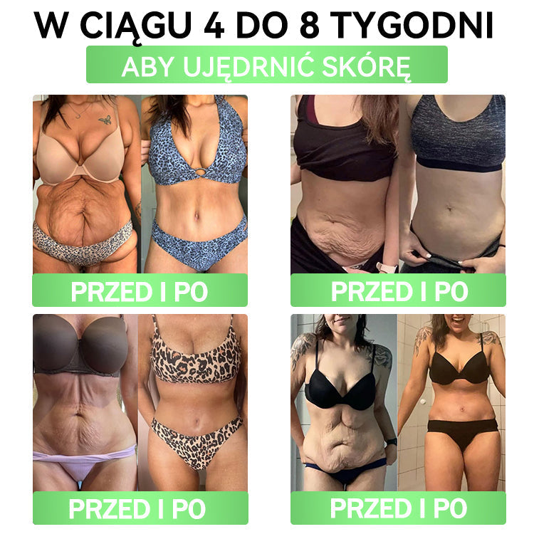 🪶💙𝑨𝑵𝑮𝑬𝑳𝑻𝑹𝑨𝑷® Moringa × Berberyna × AMPK 10-w-1 Wsparcie metaboliczne, plaster z nanotechnologią mikroigłową 🇵🇱(Wystarczy raz dziennie, widoczne efekty w 7 dni) ✅ Na otyłość, wiotką skórę, bezdech senny, problemy ze stawami i wiele innych