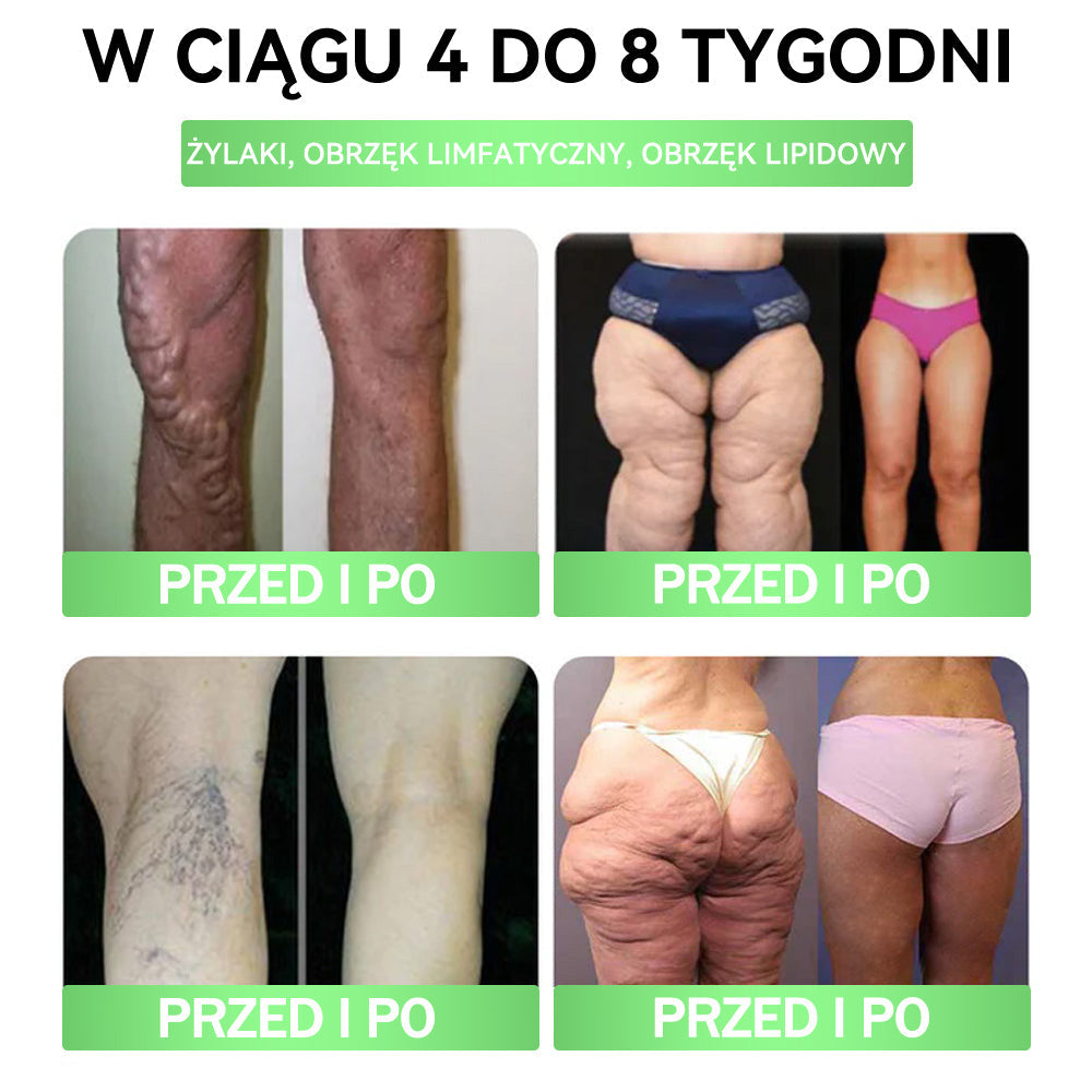 🪶💙𝑨𝑵𝑮𝑬𝑳𝑻𝑹𝑨𝑷® Moringa × Berberyna × AMPK 10-w-1 Wsparcie metaboliczne, plaster z nanotechnologią mikroigłową 🇵🇱(Wystarczy raz dziennie, widoczne efekty w 7 dni) ✅ Na otyłość, wiotką skórę, bezdech senny, problemy ze stawami i wiele innych