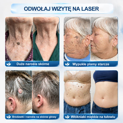 HISKIN® 🎁🎁🎁 Zostało już tylko 10 opakowań! Teraz otrzymujesz dodatkowe 50% rabatu! Nie przegap tej specjalnej oferty, ponieważ taka sama zniżka ponownie pojawi się dopiero za dłuższy czas.