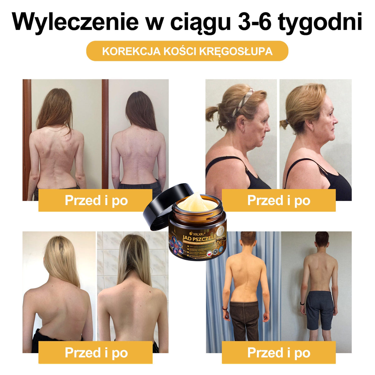 🎉XRLXRL® Krem z jadem pszczelim o natychmiastowym, wyjątkowo silnym działaniu przeciwbólowym – (Łagodzi ból związany z zapaleniem stawów, bólem mięśni i pleców oraz dolegliwościami kolan, barków, bioder, nadgarstków i dłoni)