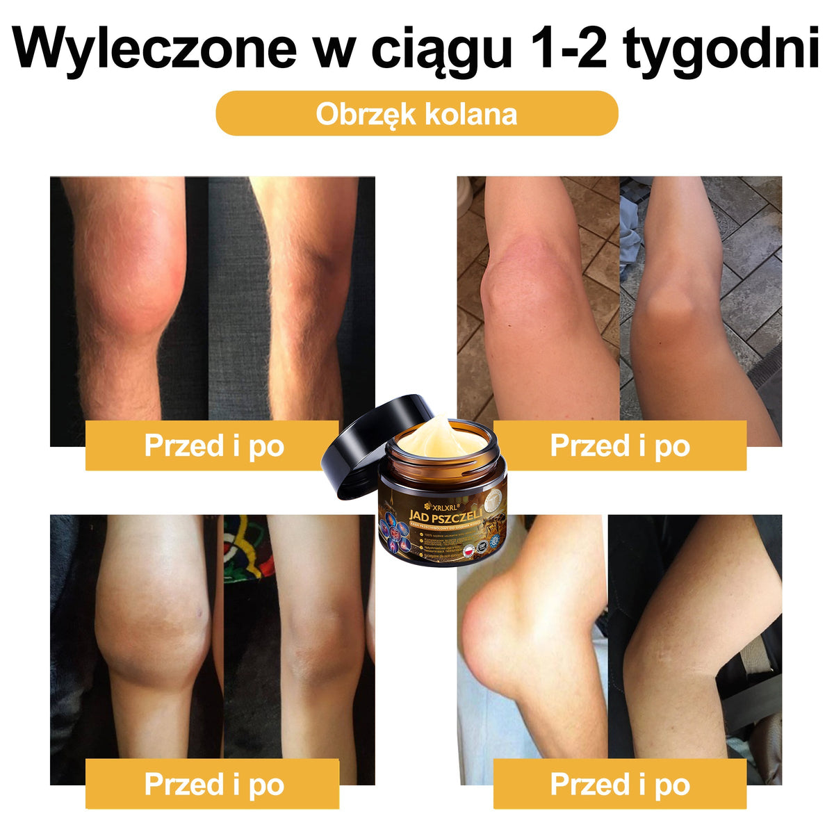 🎉XRLXRL® Krem z jadem pszczelim o natychmiastowym, wyjątkowo silnym działaniu przeciwbólowym – (Łagodzi ból związany z zapaleniem stawów, bólem mięśni i pleców oraz dolegliwościami kolan, barków, bioder, nadgarstków i dłoni)
