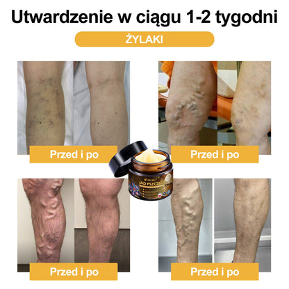 🎉XRLXRL® Krem z jadem pszczelim o natychmiastowym, wyjątkowo silnym działaniu przeciwbólowym – (Łagodzi ból związany z zapaleniem stawów, bólem mięśni i pleców oraz dolegliwościami kolan, barków, bioder, nadgarstków i dłoni)