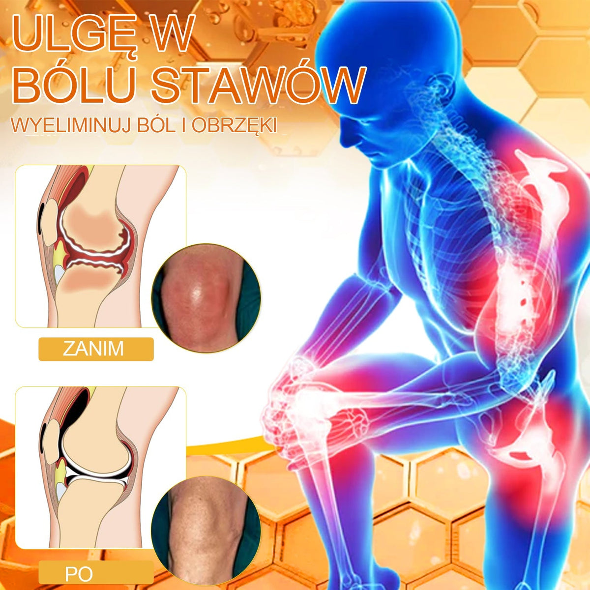 🎉XRLXRL® Krem z jadem pszczelim o natychmiastowym, wyjątkowo silnym działaniu przeciwbólowym – (Łagodzi ból związany z zapaleniem stawów, bólem mięśni i pleców oraz dolegliwościami kolan, barków, bioder, nadgarstków i dłoni)