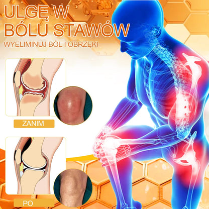 🎉XRLXRL® Krem z jadem pszczelim o natychmiastowym, wyjątkowo silnym działaniu przeciwbólowym – (Łagodzi ból związany z zapaleniem stawów, bólem mięśni i pleców oraz dolegliwościami kolan, barków, bioder, nadgarstków i dłoni)