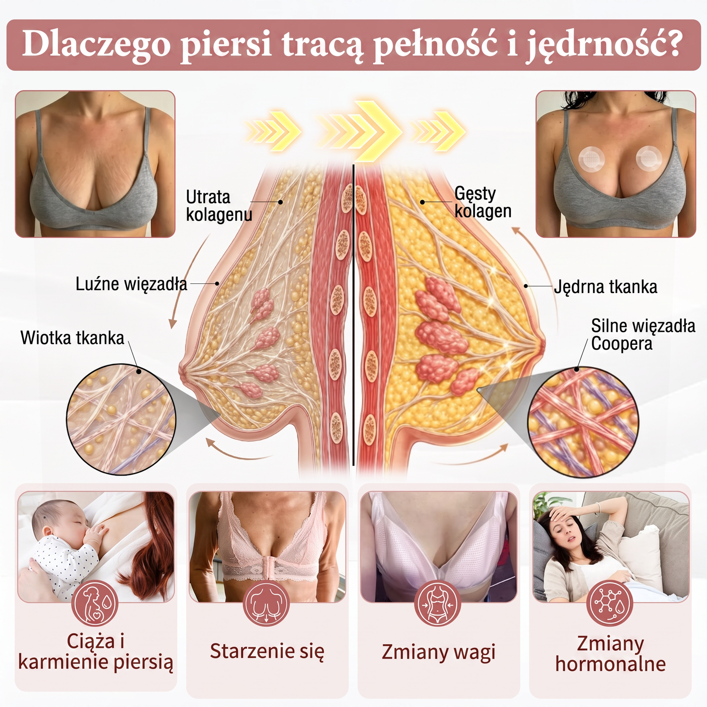 💛HISKIN® Mikroigłowe plastry na piersi wspierające efekt pełniejszego wyglądu, liftingu i ujędrnienia