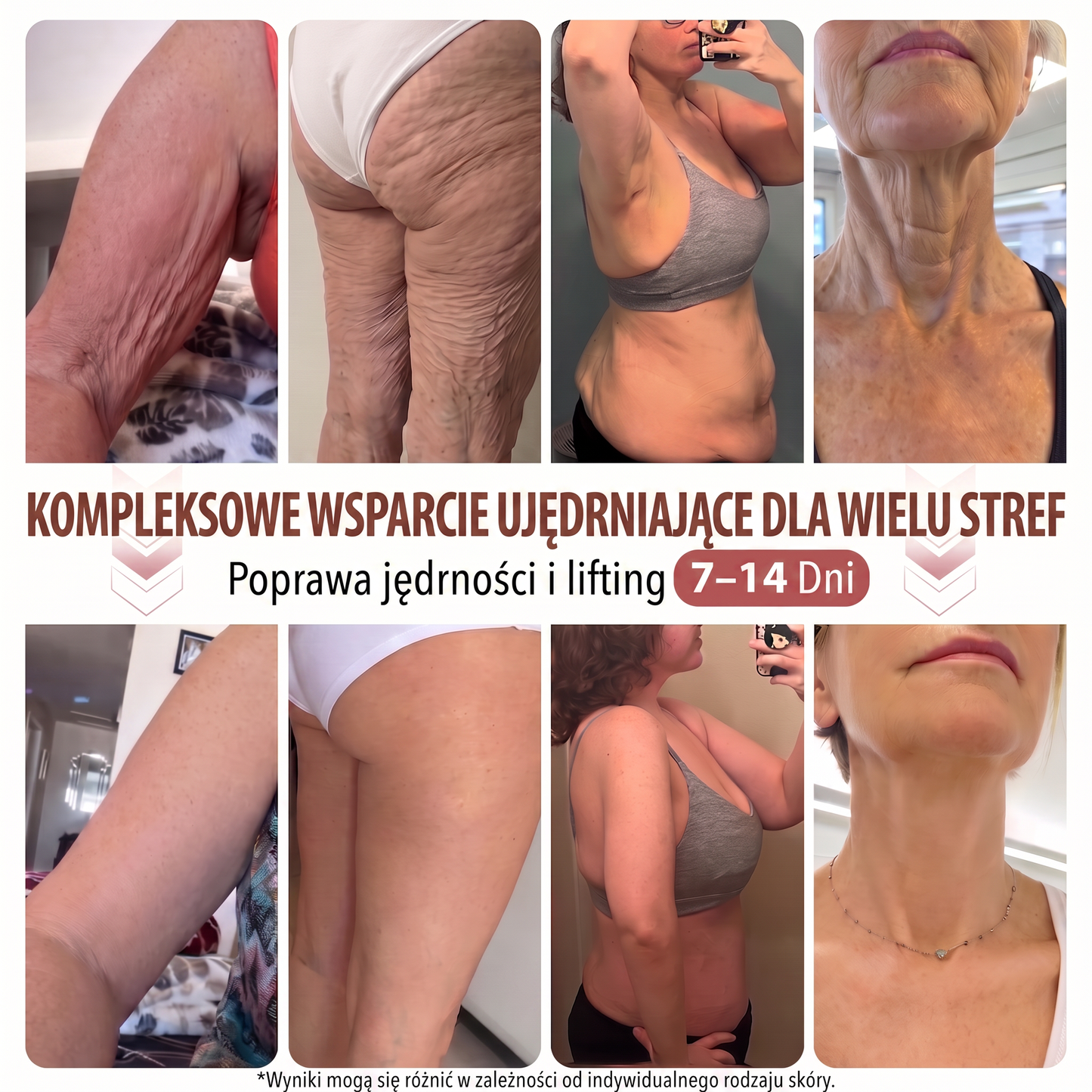 💛HISKIN® Mikroigłowe plastry na piersi wspierające efekt pełniejszego wyglądu, liftingu i ujędrnienia